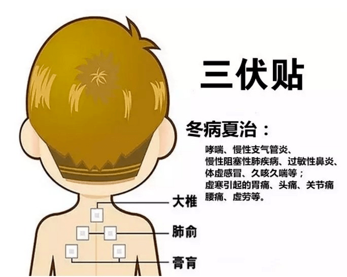 1、三伏貼多大？寶寶能貼多少？</p><p>三伏貼孩子貼多久？